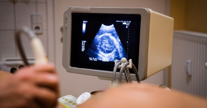 Kết quả siêu âm có xác định được linh hồn thai nhi không